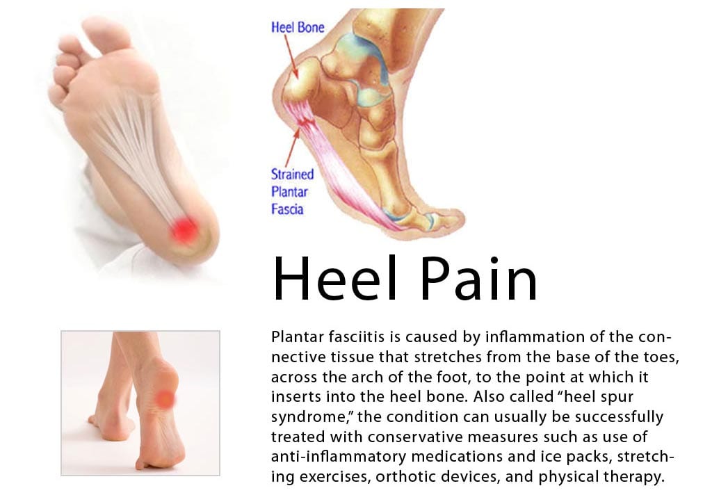 bottom of heel pain