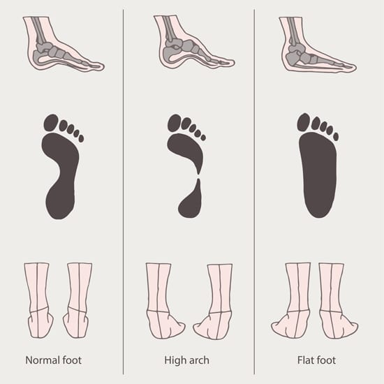 Personality traits revealed by the shape of your foot arch | - Times of  India