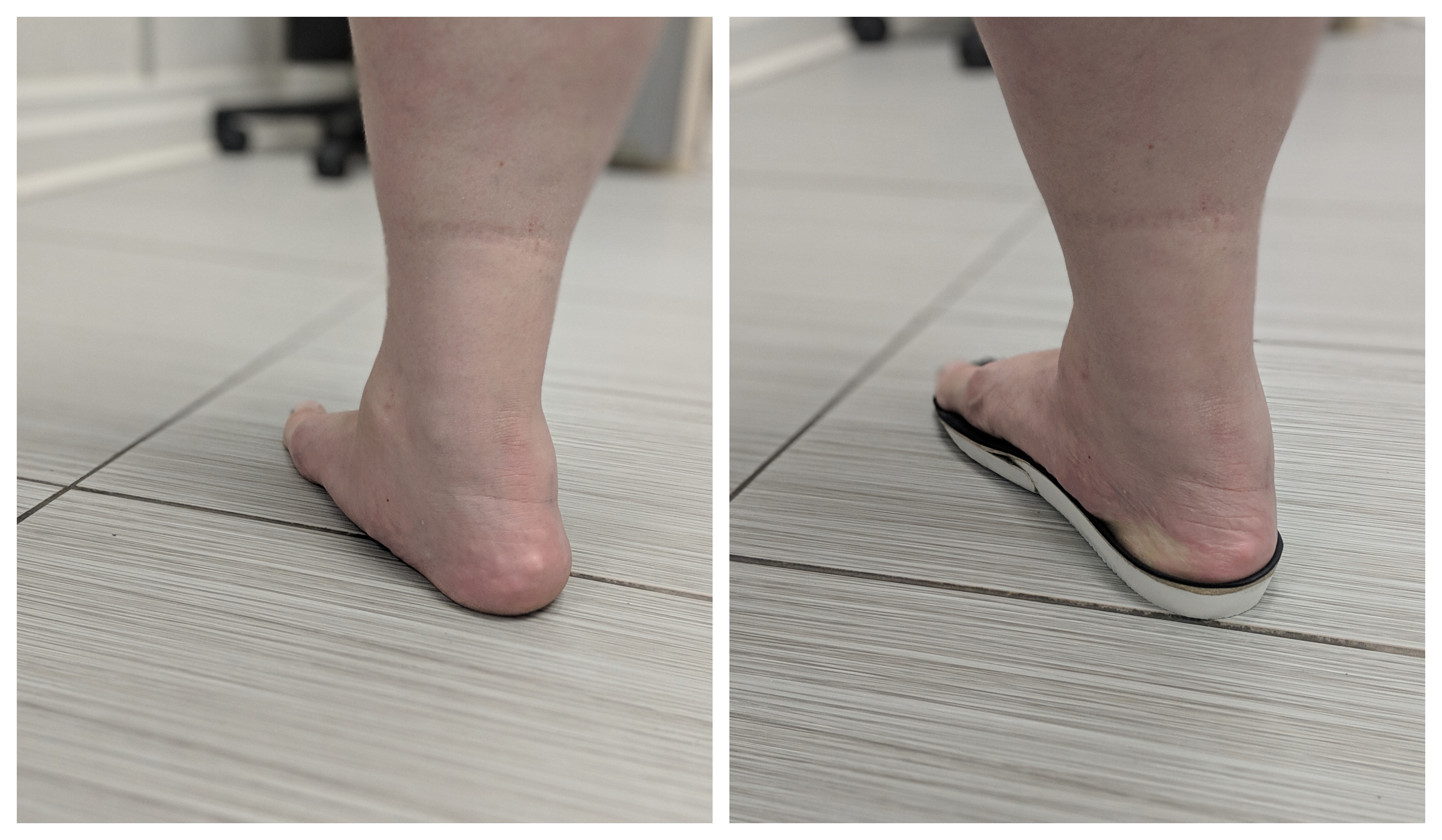 Stretches for Flat Feet | Queen City Foot and Ankle Specialists